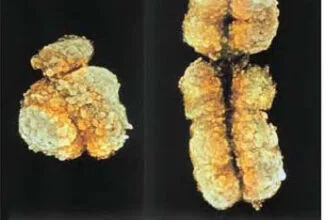 Sex chromosomes and Sex Determination